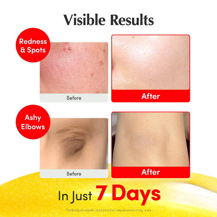 [EQQUALBERRY] Vitamin Illuminating Serum 30ml