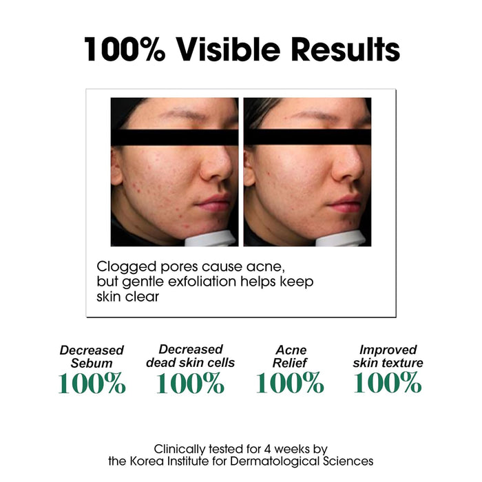 [SOMEBYMI] AHA-BHA-PHA 30 DAYS MIRACLE TONER [150ml]